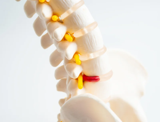 Neurochirurgo a Messina: Dott. Emanuele Puglisi, Chirurgia Vertebrale